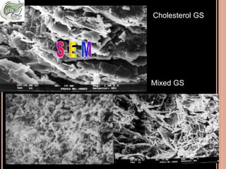Cholesterol GS
Mixed GS
 