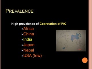 PREVALENCE
High prevalence of Coarctation of IVC
Africa
China
India
Japan
Nepal
USA (few)
 