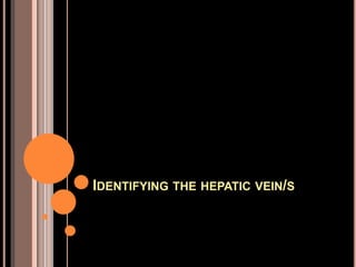 IDENTIFYING THE HEPATIC VEIN/S
 