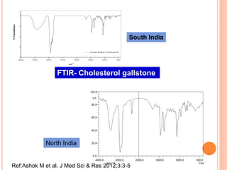 4000 3500 3000 2500 2000 1500 1000 500
South Indian Cholesterol
%Transmittance
cm
-1
FTIR- Cholesterol gallstone
North India
South India
Ref:Ashok M et al. J Med Sci & Res 2012;3:3-5
 