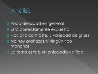  Poca densidad en general
 Está correctamente expuesta
 Hay alto contraste, y variedad de grises
 No hay arañazos ni ningún tipo
manchas
 La toma esta bien enfocada y nítida
 