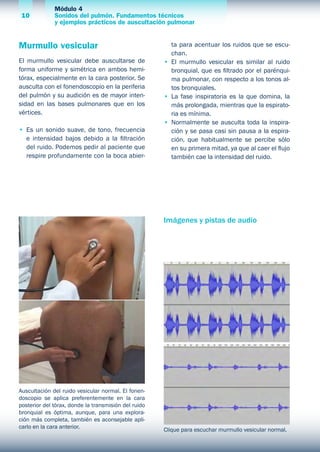 Módulo 4
Sonidos del pulmón. Fundamentos técnicos
y ejemplos prácticos de auscultación pulmonar
10
Murmullo vesicular
El murmullo vesicular debe auscultarse de
forma uniforme y simétrica en ambos hemi-
tórax, especialmente en la cara posterior. Se
ausculta con el fonendoscopio en la periferia
del pulmón y su audición es de mayor inten-
sidad en las bases pulmonares que en los
vértices.
•	 Es un sonido suave, de tono, frecuencia
e intensidad bajos debido a la filtración
del ruido. Podemos pedir al paciente que
respire profundamente con la boca abier-
ta para acentuar los ruidos que se escu-
chan.
•	 El murmullo vesicular es similar al ruido
bronquial, que es filtrado por el parénqui-
ma pulmonar, con respecto a los tonos al-
tos bronquiales.
•	 La fase inspiratoria es la que domina, la
más prolongada, mientras que la espirato-
ria es mínima.
•	 Normalmente se ausculta toda la inspira-
ción y se pasa casi sin pausa a la espira-
ción, que habitualmente se percibe sólo
en su primera mitad, ya que al caer el flujo
también cae la intensidad del ruido.
Auscultación del ruido vesicular normal. El fonen-
doscopio se aplica preferentemente en la cara
posterior del tórax, donde la transmisión del ruido
bronquial es óptima, aunque, para una explora-
ción más completa, también es aconsejable apli-
carlo en la cara anterior. Clique para escuchar murmullo vesicular normal.
Imágenes y pistas de audio
 