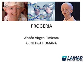 PROGERIA
Abdón Virgen Pimienta
GENETICA HUMANA
 