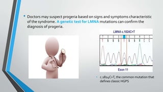 • Doctors may suspect progeria based on signs and symptoms characteristic
of the syndrome. A genetic test for LMNA mutations can confirm the
diagnosis of progeria.
• c.1824C>T, the common mutation that
defines classic HGPS
 