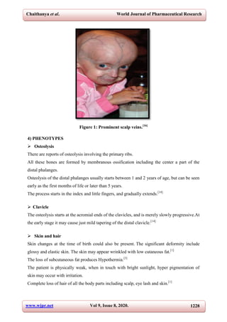 Chaithanya et al. World Journal of Pharmaceutical Research
www.wjpr.net Vol 9, Issue 8, 2020. 1228
Figure 1: Prominent scalp veins.[16]
4) PHENOTYPES
 Osteolysis
There are reports of osteolysis involving the primary ribs.
All these bones are formed by membranous ossification including the center a part of the
distal phalanges.
Osteolysis of the distal phalanges usually starts between 1 and 2 years of age, but can be seen
early as the first months of life or later than 5 years.
The process starts in the index and little fingers, and gradually extends.[14]
 Clavicle
The osteolysis starts at the acromial ends of the clavicles, and is merely slowly progressive.At
the early stage it may cause just mild tapering of the distal clavicle.[14]
 Skin and hair
Skin changes at the time of birth could also be present. The significant deformity include
glossy and elastic skin. The skin may appear wrinkled with low cutaneous fat.[1]
The loss of subcutaneous fat produces Hypothermia.[3]
The patient is physically weak, when in touch with bright sunlight, hyper pigmentation of
skin may occur with irritation.
Complete loss of hair of all the body parts including scalp, eye lash and skin.[1]
 