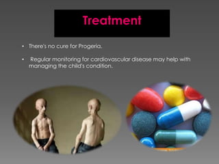 Treatment
• There's no cure for Progeria.

•   Regular monitoring for cardiovascular disease may help with
    managing the child's condition.
 
