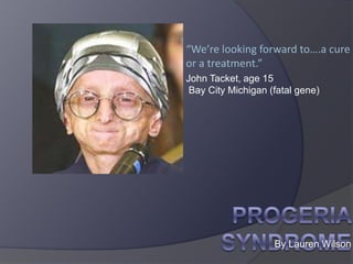 “We’re looking forward to….a cure or a treatment.” John Tacket, age 15  Bay City Michigan (fatal gene) Progeria syndrome By Lauren Wilson 