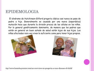 EPIDEMOLOGIA El síndrome de Hutchinson-Gilford progeria clásica casi nunca se pasa de padre a hijo. Generalmente es causada por una nueva (esporádica) mutación hace que durante la división precoz de las células en los niños. Por lo general genéticamente dominante, de manera que los padres que están en general en buen estado de salud están lejos de sus hijos. Los niños afectados rara vez viven lo suficiente como para tener hijos propios. ttp://www.homebuycenter.com/an-overview-on-progeria-a-rare-disease-of-child/ 