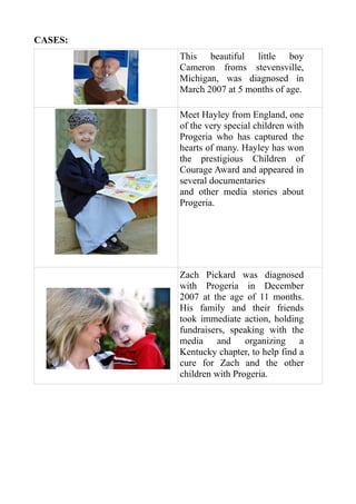 CASES:
         This beautiful little boy
         Cameron froms stevensville,
         Michigan, was diagnosed in
         March 2007 at 5 months of age.

         Meet Hayley from England, one
         of the very special children with
         Progeria who has captured the
         hearts of many. Hayley has won
         the prestigious Children of
         Courage Award and appeared in
         several documentaries
         and other media stories about
         Progeria.




         Zach Pickard was diagnosed
         with Progeria in December
         2007 at the age of 11 months.
         His family and their friends
         took immediate action, holding
         fundraisers, speaking with the
         media and organizing a
         Kentucky chapter, to help find a
         cure for Zach and the other
         children with Progeria.
 