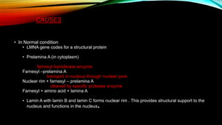 CAUSES
• In Normal condition
• LMNA gene codes for a structural protein
• Prelamina A (in cytoplasm)
farnesyl transferase enzyme
Farnesyl –prelamina A
transport in nucleus through nuclear pore
Nuclear rim + farnesyl – prelamina A
cleaved by specific protease enzyme
Farnesyl + amino acid + lamina A
• Lamin A with lamin B and lamin C forms nuclear rim . This provides structural support to the
nucleus and functions in the nucleus.
 