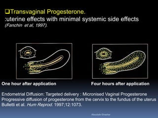 Transvaginal Progesterone. :uterine effects with minimal systemic side effects (Fanchin et al, 1997). 
One hour after application Four hours after application 
Endometrial Diffusion: Targeted delivery : Micronised Vaginal Progesterone 
Progressive diffusion of progesterone from the cervix to the fundus of the uterus Bulletti et al. Hum Reprod. 1997;12:1073. 
Aboubakr Elnashar 
 