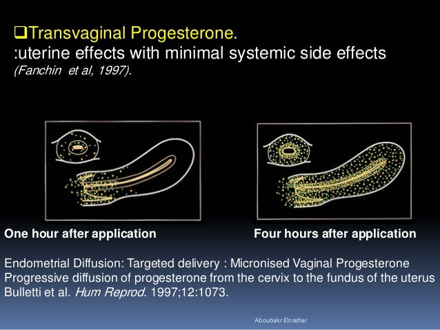 Prometrium Vs Progesterone