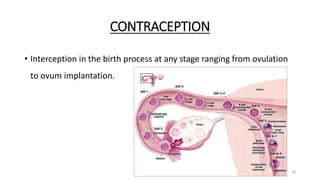 CONTRACEPTION
• Interception in the birth process at any stage ranging from ovulation
to ovum implantation.
20
 