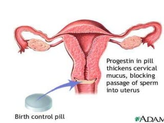 Progesterone itself increases basal insulin levels and the rise in insulin after carbohydrate ingestion, but it does not normally alter glucose tolerance. However, long-term administration of more potent progestins, such as norgestrel, may decrease glucose toleranceProgesterone stimulates lipoprotein lipase activity and seems to enhance fat deposition. Progesterone and analogs such as MPA have been reported to increase LDL and cause either no effects or modest reductions in serum HDL levels. Progesterone also may diminish the effects of aldosterone in the renal tubule and cause a decrease in sodium reabsorption that may increase mineralocorticoid secretion from the adrenal cortex.Metabolic Effects