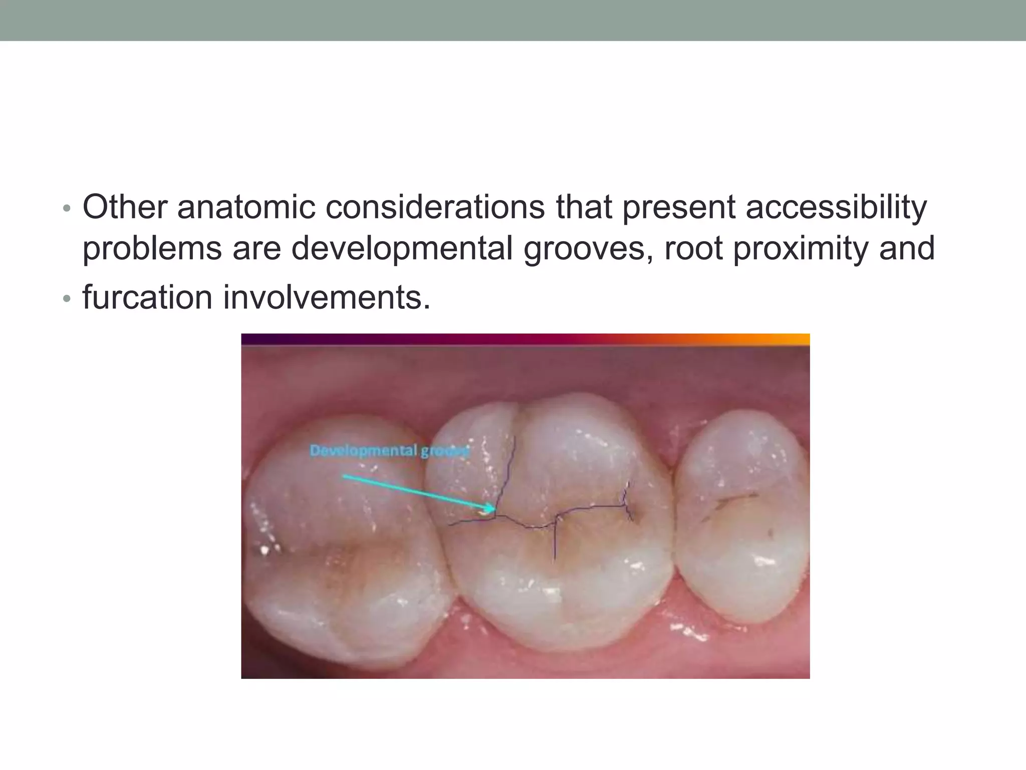 Prognosis | PPTX