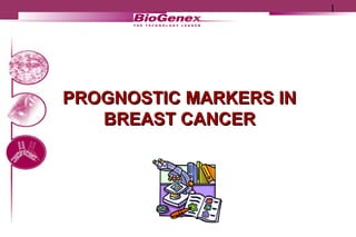 1
Rev. 29
PROGNOSTIC MARKERS INPROGNOSTIC MARKERS IN
BREAST CANCERBREAST CANCER
 