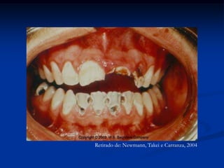 Retirado de: Newmann, Takei e Carranza, 2004