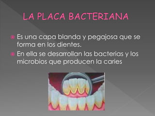  Es una capa blanda y pegajosa que se
forma en los dientes.
 En ella se desarrollan las bacterias y los
microbios que producen la caries
 