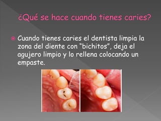  Cuando tienes caries el dentista limpia la
zona del diente con “bichitos”, deja el
agujero limpio y lo rellena colocando un
empaste.
 