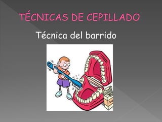 Técnica del barrido
 
