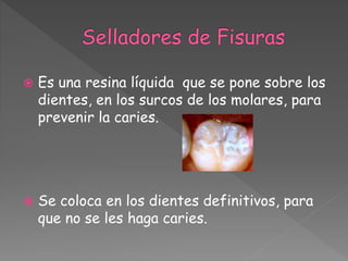  Es una resina líquida que se pone sobre los
dientes, en los surcos de los molares, para
prevenir la caries.
 Se coloca en los dientes definitivos, para
que no se les haga caries.
 