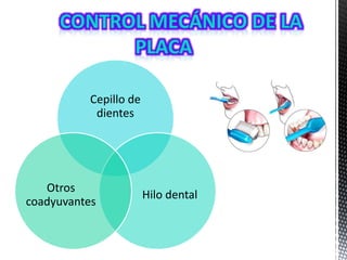 Cepillo de
dientes
Hilo dental
Otros
coadyuvantes
 
