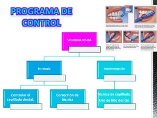 SEGUNDA VISITA
Estrategia
Controlar el
cepillado dental.
Corrección de
técnica
Implementación
Técnica de cepillado.
Uso de hilo dental.
 