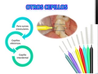 Para surcos
creviculares.
Cepillos
eléctricos.
Cepillo
interdental
 