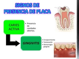 CARIES
ACTIVA
• Presencia
de
cavidades
abiertas.
GINGIVITIS
• Enrojecimiento
• Tumoración
• Hemorragia
gingival.
 