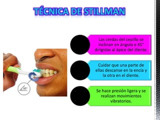 Las cerdas del cepillo se
inclinan en ángulo e 45°
dirigidas al ápice del diente.
Cuidar que una parte de
ellas descanse en la encía y
la otra en el diente.
Se hace presión ligera y se
realizan movimientos
vibratorios.
 