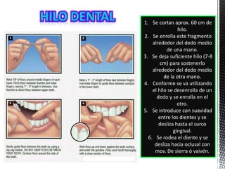 1. Se cortan aprox. 60 cm de
hilo.
2. Se enrolla este fragmento
alrededor del dedo medio
de una mano.
3. Se deja suficiente hilo (7-8
cm) para sostenerlo
alrededor del dedo medio
de la otra mano.
4. Conforme se va utilizando
el hilo se desenrolla de un
dedo y se enrolla en el
otro.
5. Se introduce con suavidad
entre los dientes y se
desliza hasta el surco
gingival.
6. Se rodea el diente y se
desliza hacia oclusal con
mov. De sierra ó vaivén.
 