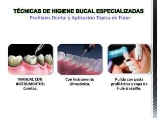 Profilaxis Dental y Aplicación Tópica de Flúor
MANUAL CON
INSTRUMENTOS:
Curetas.
Con instrumento
Ultrasónico.
Pulido con pasta
profiláctica y copa de
hule ó cepillo.
 