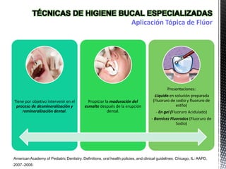 Aplicación Tópica de Flúor
Tiene por objetivo intervenir en el
proceso de desmineralización y
remineralización dental.
Propiciar la maduración del
esmalte después de la erupción
dental.
Presentaciones:
-Líquido en solución preparada
(Fluoruro de sodio y fluoruro de
estño)
- En gel (Fluoruro Acidulado)
- Barnicez Fluorados (Fluoruro de
Sodio)
American Academy of Pediatric Dentistry. Definitions, oral health policies, and clinical guidelines. Chicago, IL: AAPD,
2007–2008.
 