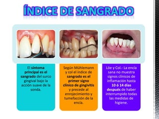 El síntoma
principal es el
sangrado del surco
gingival bajo la
acción suave de la
sonda.
Según Mühlemann
y col el índice de
sangrado es el
primer signo
clínico de gingivitis
y precede al
enrojecimiento y
tumefacción de la
encía.
Löe y Col.- La encía
sana no muestra
signos clínicos de
inflamación hasta
10 ó 14 días
después de haber
interrumpido todas
las medidas de
higiene.
 