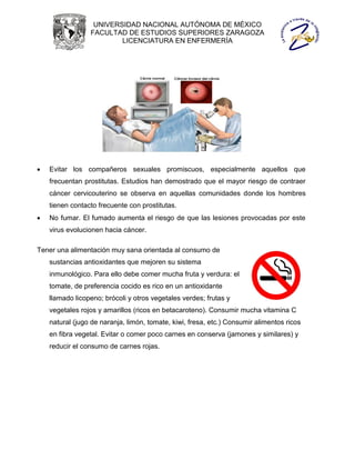 UNIVERSIDAD NACIONAL AUTÓNOMA DE MÉXICO
                 FACULTAD DE ESTUDIOS SUPERIORES ZARAGOZA
                         LICENCIATURA EN ENFERMERÍA




   Evitar los compañeros sexuales promiscuos, especialmente aquellos que
    frecuentan prostitutas. Estudios han demostrado que el mayor riesgo de contraer
    cáncer cervicouterino se observa en aquellas comunidades donde los hombres
    tienen contacto frecuente con prostitutas.
   No fumar. El fumado aumenta el riesgo de que las lesiones provocadas por este
    virus evolucionen hacia cáncer.

Tener una alimentación muy sana orientada al consumo de
    sustancias antioxidantes que mejoren su sistema
    inmunológico. Para ello debe comer mucha fruta y verdura: el
    tomate, de preferencia cocido es rico en un antioxidante
    llamado licopeno; brócoli y otros vegetales verdes; frutas y
    vegetales rojos y amarillos (ricos en betacaroteno). Consumir mucha vitamina C
    natural (jugo de naranja, limón, tomate, kiwi, fresa, etc.) Consumir alimentos ricos
    en fibra vegetal. Evitar o comer poco carnes en conserva (jamones y similares) y
    reducir el consumo de carnes rojas.
 