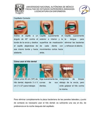 UNIVERSIDAD NACIONAL AUTÓNOMA DE MÉXICO
               FACULTAD DE ESTUDIOS SUPERIORES ZARAGOZA
                       LICENCIATURA EN ENFERMERÍA


Cepillado Correcto




Incline   el   cepillo   a   un Cepille     suavemente      el Cepille   suavemente
ángulo de 45° contra el exterior e interior y la la                   lengua     para
borde de la encía y deslice superficie de masticación eliminar las bacterias
el cepillo alejándose de de              cada    diente   con y refrescar el aliento.
ese mismo borde y hacia movimientos cortos hacia
adelante.                       atrás.



Cómo usar el hilo dental




Utilice unos 45 cm (18") de Siga suavemente las Asegúrese                de    limpiar
hilo dental, dejando 3 ó 5 curvas           de      sus debajo de la encía, pero
cm (1 ó 2") para trabajar.      dientes.                  evite golpear el hilo contra
                                                          la misma.




Para eliminar completamente la placa bacteriana de las paredes laterales y punto
de contacto es necesario usar el hilo dental: es suficiente una vez al día, de
preferencia en la noche después del cepillado.
 