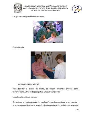 UNIVERSIDAD NACIONAL AUTÓNOMA DE MÉXICO
             FACULTAD DE ESTUDIOS SUPERIORES ZARAGOZA
                     LICENCIATURA EN ENFERMERÍA


Cirugía para extirpar el tejido canceroso.




Quimioterapia




      MEDIDAS PREVENTIVAS

Para detectar el cáncer de mama, se utilizan diferentes pruebas como
la mamografía, ultrasonido (ecografía), y la autoexploración.

La autoexploración de mamas.

Consiste en la propia observación y palpación que la mujer hace a sus mamas y
sirve para poder detectar la aparición de alguna alteración en la forma o tamaño

                                                                              90
 