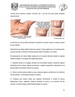 UNIVERSIDAD NACIONAL AUTÓNOMA DE MÉXICO
              FACULTAD DE ESTUDIOS SUPERIORES ZARAGOZA
                      LICENCIATURA EN ENFERMERÍA


normal de los pechos, bordes, tumores, etc. y de ser así para poder tratarlas
precozmente.




La técnica es muy sencilla y también te ayudara a conocer mejor tu cuerpo y saber
como cuidarlo.

Esta técnica se debe realizar todos los meses 7 días posteriores a la menstruación
ya que durante o antes las mamas puedan estar hinchadas o con dolor.

El autoexamen de mama debe hacerse con el cuerpo desnudo desde la cabeza
hasta la cadera, y se siguen los siguientes pasos:

1.- Situarse frente a un espejo, primero con los brazos caídos y observar alguna
asimetría en las mamas, alguna tumoración, o alguna rugosidad o depresión en la
piel de ellas si la hubiera tenerlo en cuenta.

2.- Ahora con las manos sobre la nuca, observar alguna asimetría en el contorno
de las mamas, si la hubiera tenerlo en cuenta.

3.- Coloque sus manos sobre sus caderas firmemente, e incline el tronco
ligeramente hacia adelante. observe también la forma y el contorno de las
mamas, si hubiera alguna deformidad téngalo en cuenta.



                                                                               91
 