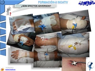 www.incativ.es
23/04/2013
12
FORMACIÓN_2 INCATIV
¿SON EFECTOS ADVERSOS?
 