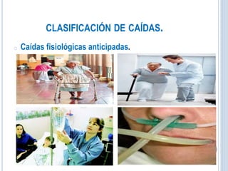 CLASIFICACIÓN DE CAÍDAS.
o Caídas fisiológicas anticipadas.
 