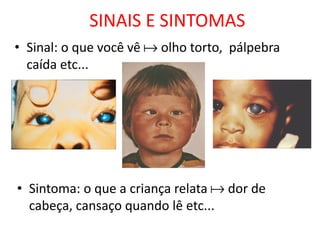 SINAIS E SINTOMAS
• Sinal: o que você vê  olho torto, pálpebra
  caída etc...




• Sintoma: o que a criança relata  dor de
  cabeça, cansaço quando lê etc...
 