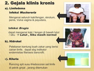 2. Gejala klinis kronis
a). Limfedema
   Infeksi Wuchereria
   Mengenai seluruh kaki/lengan, skrotum,
   penis, Vulva vagina & payudara,


  Infeksi Brugia
  dapat mengenai kaki / lengan di bawah lutut
  / siku  Lutut , Siku masih normal

b). Hidrokel

   Pelebaran kantung buah zakar yang berisi
   cairan limfe. dapat sbg indikator
   endemisitas filariasis bancrofti.

c). Kiluria

   Kencing spti susukebocoran sal limfe
   di pelvik ginjal , jarang ditemukan
 