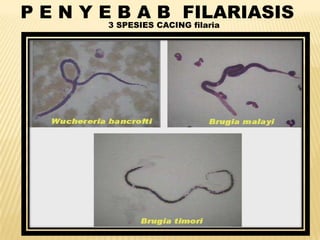 P E N Y E B A B FILARIASIS
        3 SPESIES CACING filaria
 