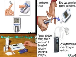Random Blood Sugar
 