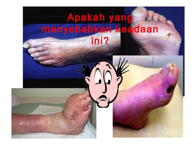 What Are The Signs Of Diabetes What Are The Signs Of Diabetes