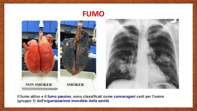Comprare inalatori nicotinic per un nikoretta