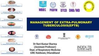 MANAGEMENT OF EXTRA-PULMONARY
TUBERCULOSIS(EPTB)
1
Dr Ravi Kumar Sharma
(Assistant Professor)
Dept. of Respiratory Medicine
GMC Haldwani, Uttarakhand
 