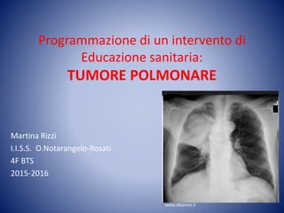 Programmazione di un intervento di
Educazione sanitaria:
TUMORE POLMONARE
Martina Rizzi
I.I.S.S. O.Notarangelo-Rosati
4F BTS
2015-2016
www.albanesi.it
 