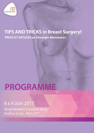 TIPS AND TRICKS in Breast Surgery!
TRUCS ET ASTUCES en Chirurgie Mammaire !
PROGRAMME
8 & 9 Juin 2017
Amphithéâtre Constant Burg
Institut Curie - Paris 5ème
 