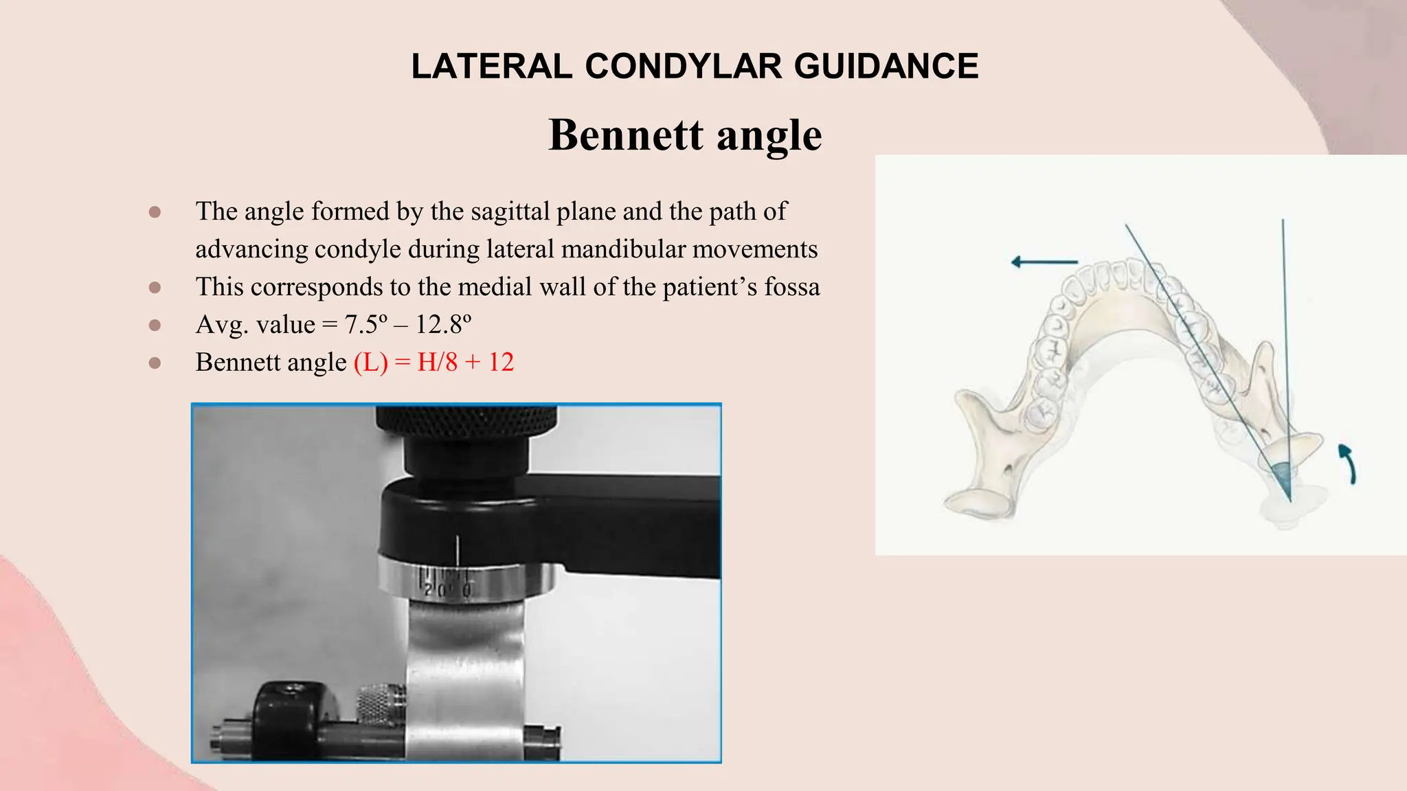 Bennett angle
● The angle formed by the sagittal plane and the path of
advancing condyle during lateral mandibular movements
● This corresponds to the medial wall of the patient’s fossa
● Avg. value = 7.5º – 12.8º
● Bennett angle (L) = H/8 + 12
LATERAL CONDYLAR GUIDANCE
 